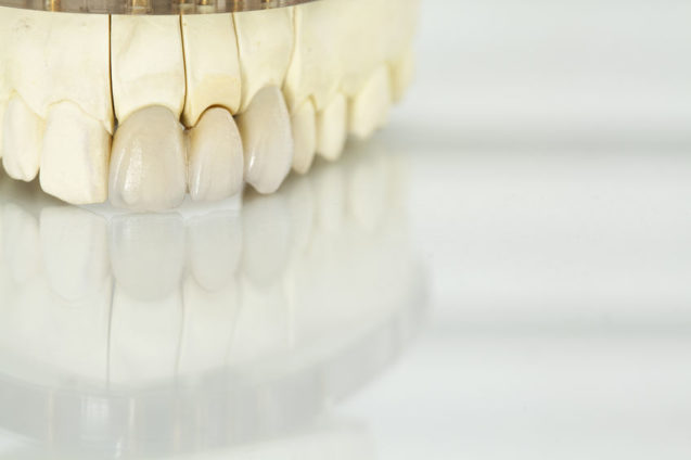 Chemicals used and practices done at biocompatible dentistry Los Angeles